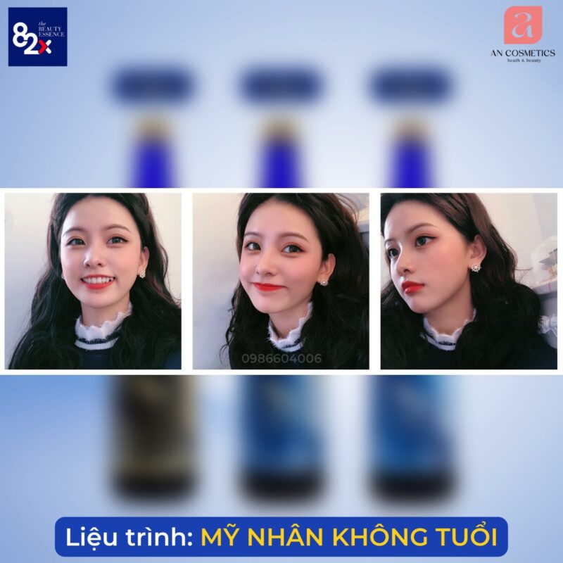 liệu trình 82x mỹ nhân không tuổi