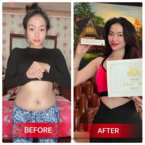 trước và sau khi sử dụng Thạch giảm cân sline Jelly nhật bản 3