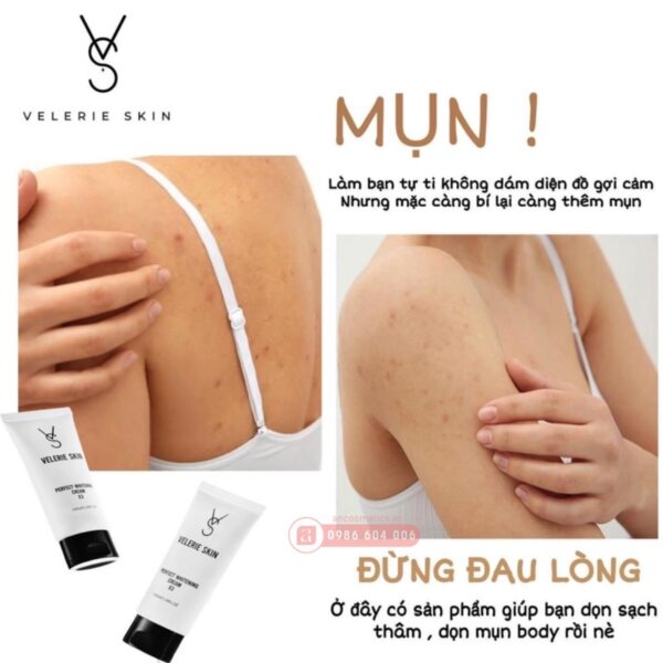 kem chữa thâm mông Velerie Skin Perfect Whitening Cream x3 5